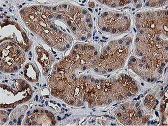 HDAC6 Antibody in Immunohistochemistry (Paraffin) (IHC (P))