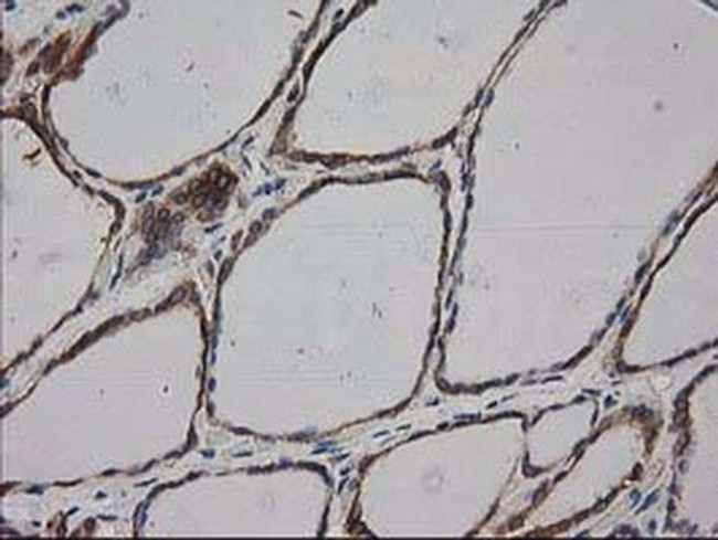 HDAC6 Antibody in Immunohistochemistry (Paraffin) (IHC (P))