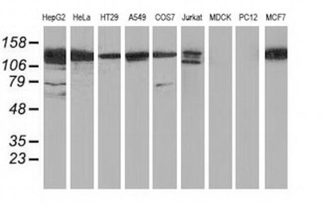 HDAC6 Antibody in Western Blot (WB)