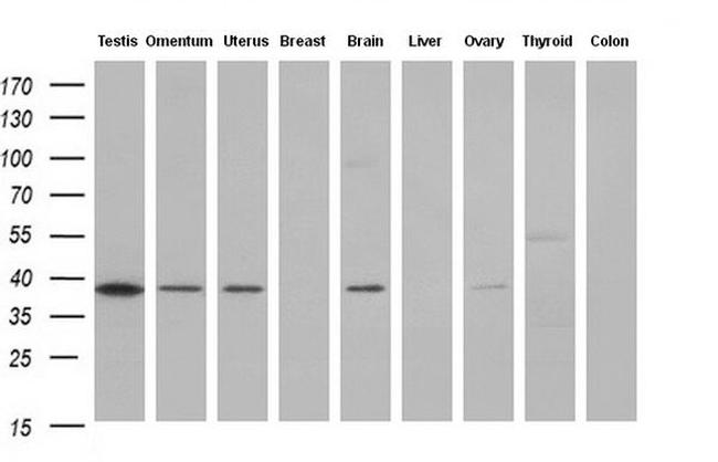 HSP40 Antibody in Western Blot (WB)