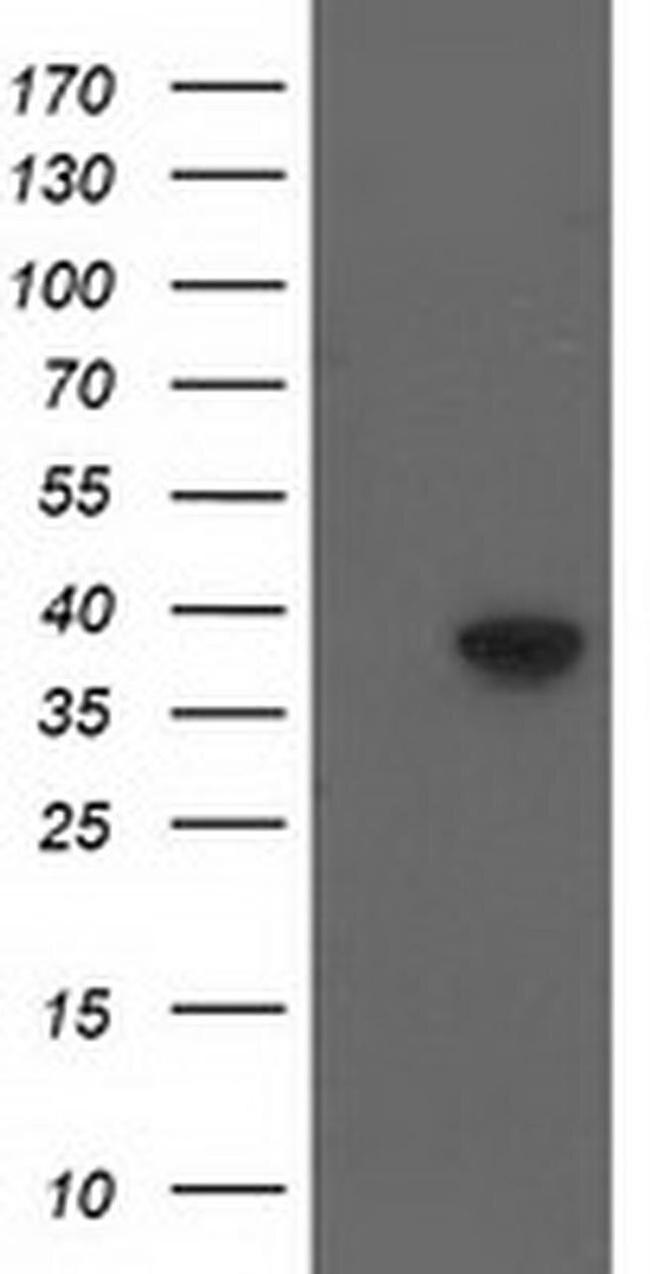 HSP40 Antibody in Western Blot (WB)