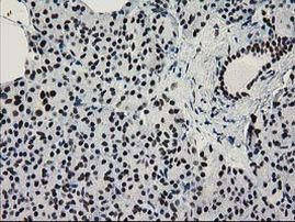 NMNAT1 Antibody in Immunohistochemistry (Paraffin) (IHC (P))