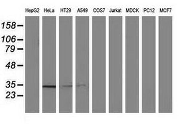 NMNAT1 Antibody in Western Blot (WB)