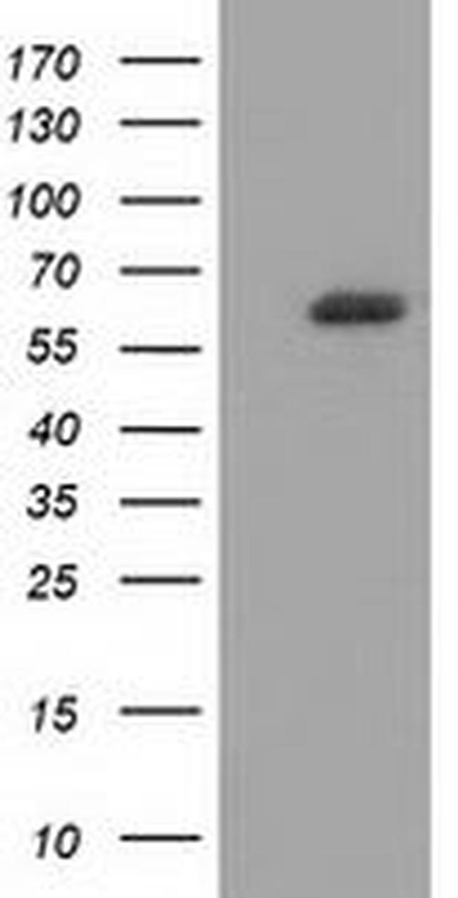 GBP5 Antibody in Western Blot (WB)