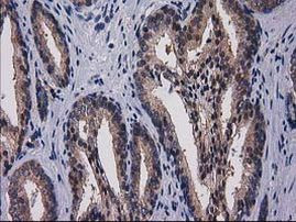 Gephyrin Antibody in Immunohistochemistry (Paraffin) (IHC (P))