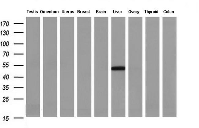 TASP1 Antibody in Western Blot (WB)