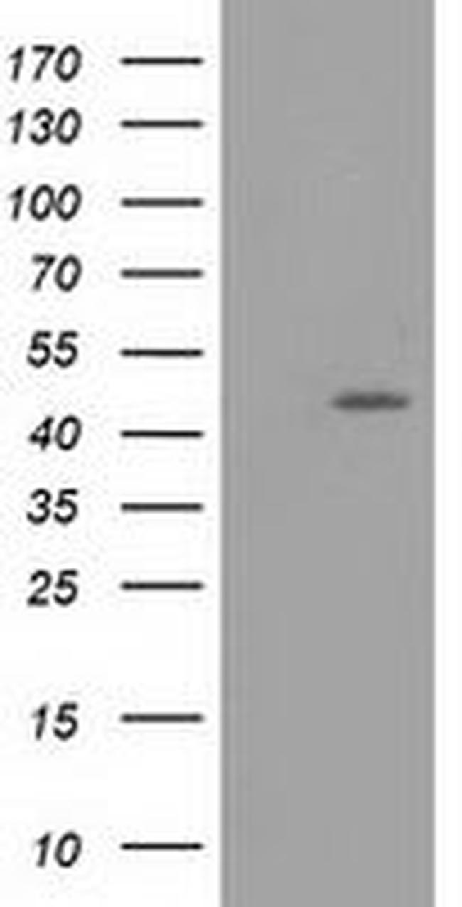 TASP1 Antibody in Western Blot (WB)