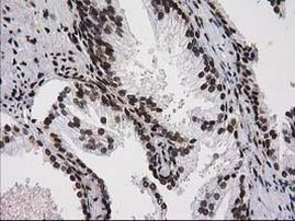 ATP6V1F Antibody in Immunohistochemistry (Paraffin) (IHC (P))