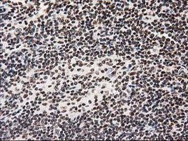 ATP6V1F Antibody in Immunohistochemistry (Paraffin) (IHC (P))