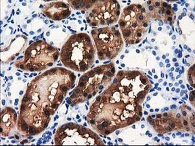 ACY3 Antibody in Immunohistochemistry (Paraffin) (IHC (P))