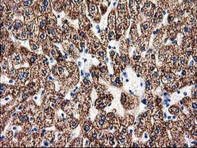 ACY3 Antibody in Immunohistochemistry (Paraffin) (IHC (P))