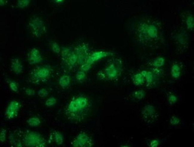 ACY3 Antibody in Immunocytochemistry (ICC/IF)