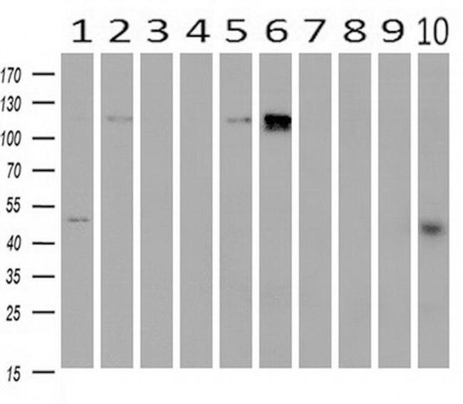 PDE2A Antibody in Western Blot (WB)