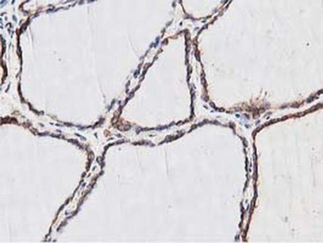 NUDT6 Antibody in Immunohistochemistry (Paraffin) (IHC (P))