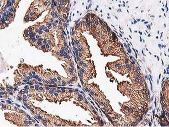 NUDT6 Antibody in Immunohistochemistry (Paraffin) (IHC (P))