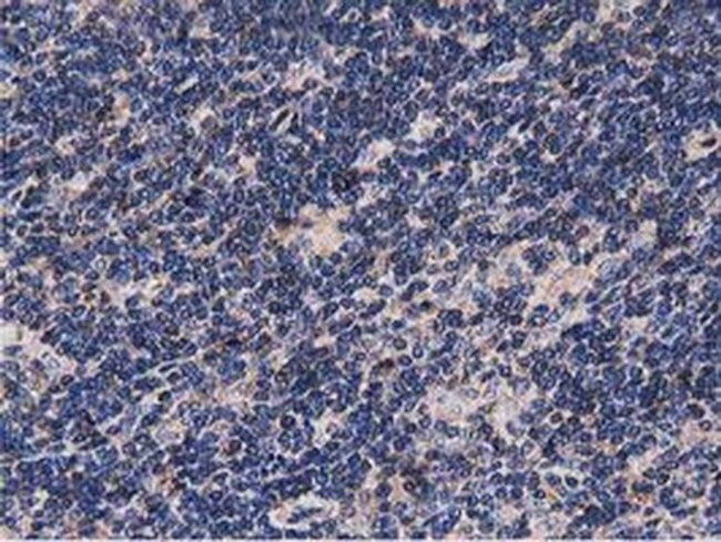 NUDT6 Antibody in Immunohistochemistry (Paraffin) (IHC (P))