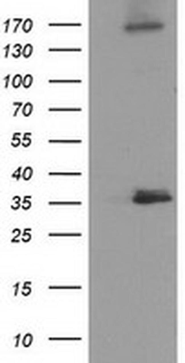 NUDT6 Antibody in Western Blot (WB)