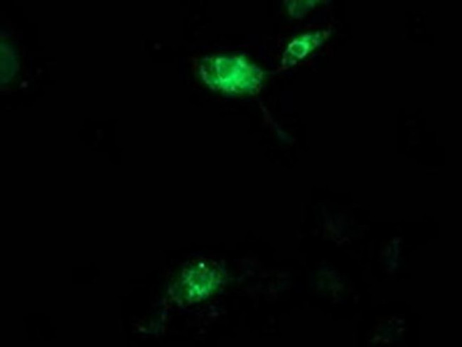 Aquaporin 1 Antibody in Immunocytochemistry (ICC/IF)