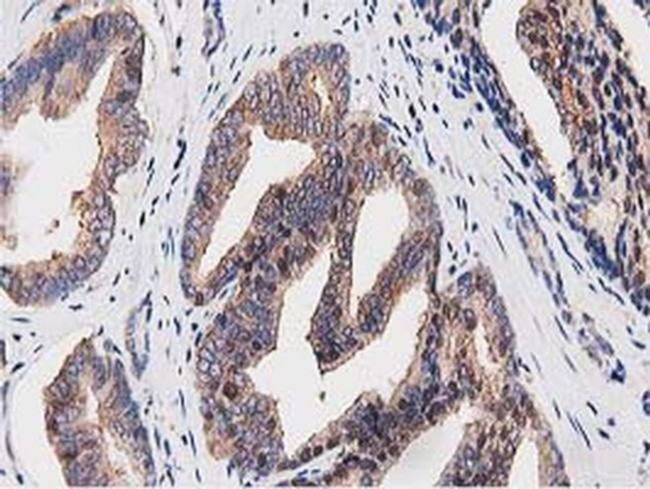 OGFOD1 Antibody in Immunohistochemistry (Paraffin) (IHC (P))