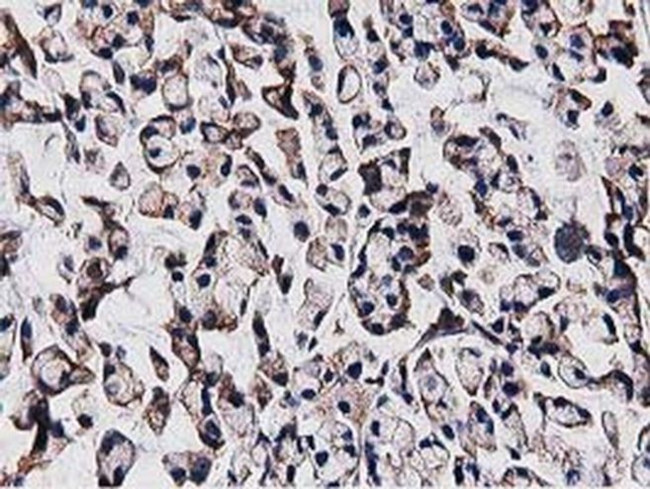 OGFOD1 Antibody in Immunohistochemistry (Paraffin) (IHC (P))