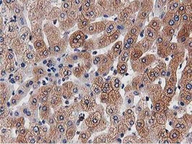 OGFOD1 Antibody in Immunohistochemistry (Paraffin) (IHC (P))