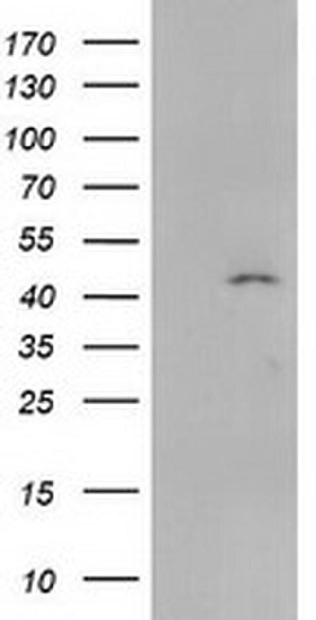 SERPINB4 Antibody in Western Blot (WB)