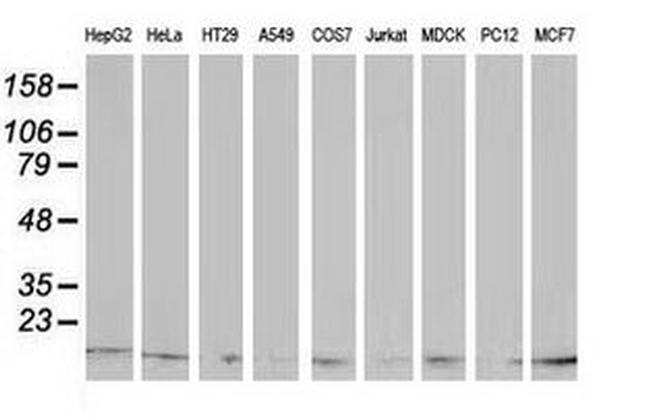 ATP6V1F Antibody in Western Blot (WB)
