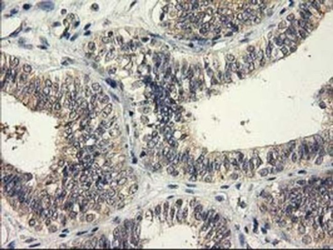 eIF4E2 Antibody in Immunohistochemistry (Paraffin) (IHC (P))