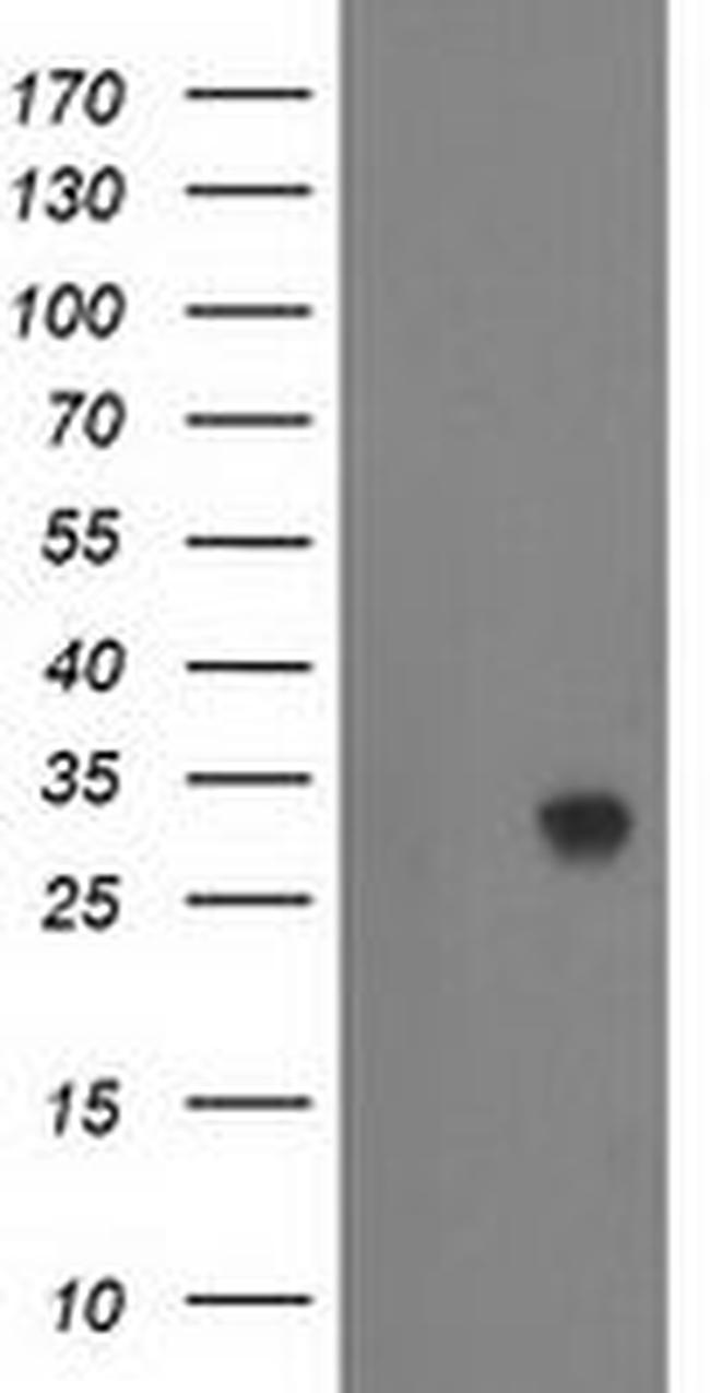 ZFAND2B Antibody in Western Blot (WB)