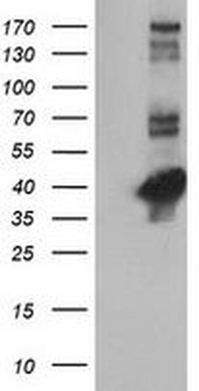 CTH Antibody in Western Blot (WB)