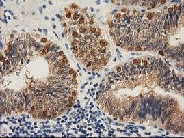 CTH Antibody in Immunohistochemistry (Paraffin) (IHC (P))