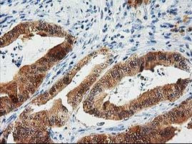 CTH Antibody in Immunohistochemistry (Paraffin) (IHC (P))