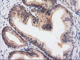 RASSF1 Antibody in Immunohistochemistry (Paraffin) (IHC (P))