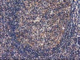 RASSF1 Antibody in Immunohistochemistry (Paraffin) (IHC (P))