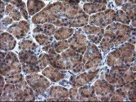 RASSF1 Antibody in Immunohistochemistry (Paraffin) (IHC (P))