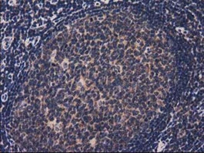 ACOT12 Antibody in Immunohistochemistry (Paraffin) (IHC (P))