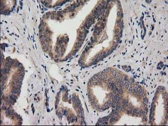 ACOT12 Antibody in Immunohistochemistry (Paraffin) (IHC (P))