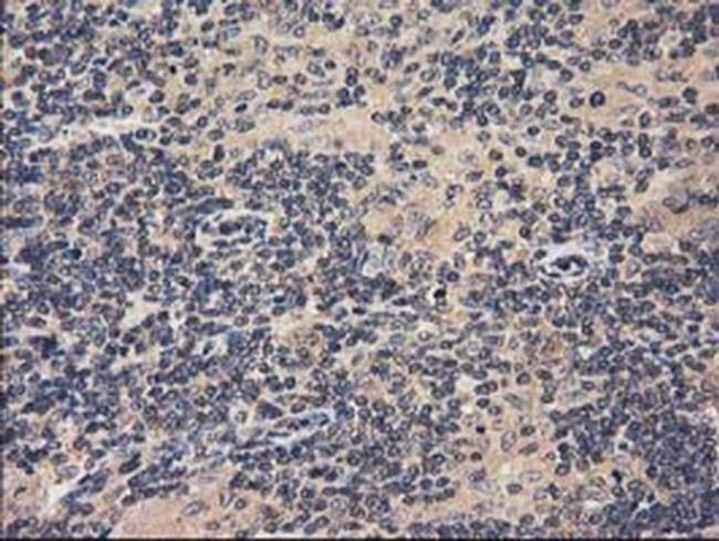 ACOT12 Antibody in Immunohistochemistry (Paraffin) (IHC (P))