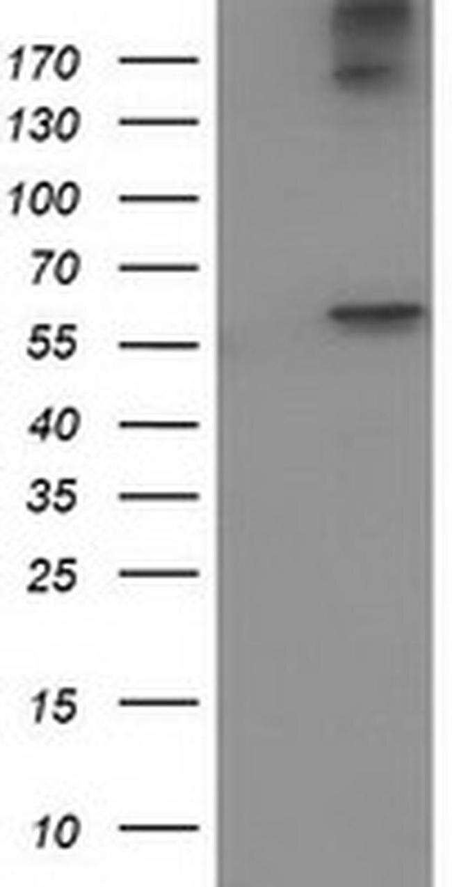 ACOT12 Antibody in Western Blot (WB)