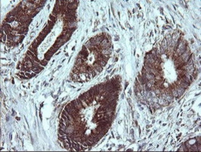 NDUFB9 Antibody in Immunohistochemistry (Paraffin) (IHC (P))