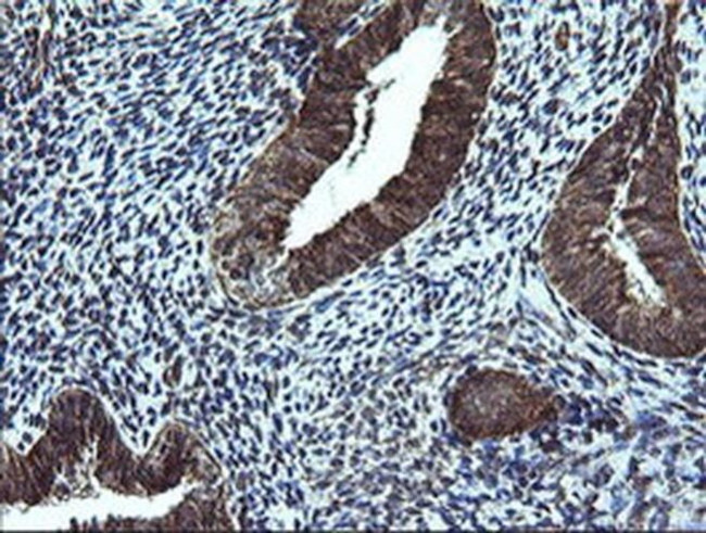 NDUFB9 Antibody in Immunohistochemistry (Paraffin) (IHC (P))