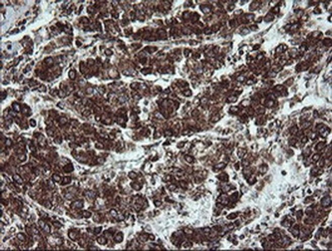 NDUFB9 Antibody in Immunohistochemistry (Paraffin) (IHC (P))