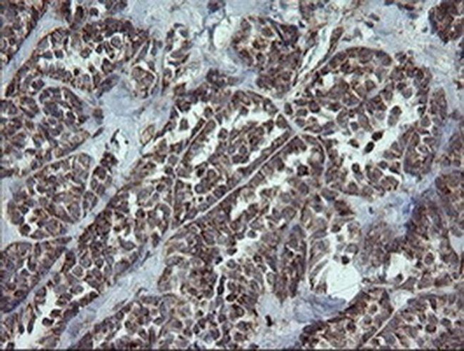 NDUFB9 Antibody in Immunohistochemistry (Paraffin) (IHC (P))