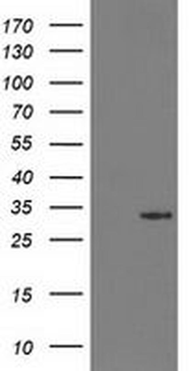 15-PGDH Antibody in Western Blot (WB)