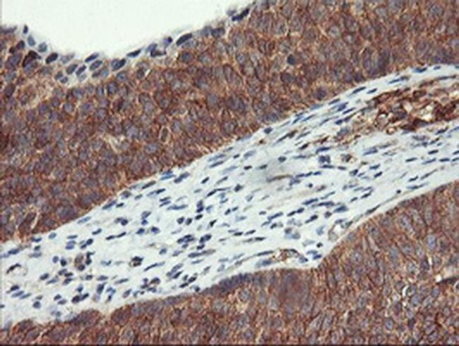 VASP Antibody in Immunohistochemistry (Paraffin) (IHC (P))