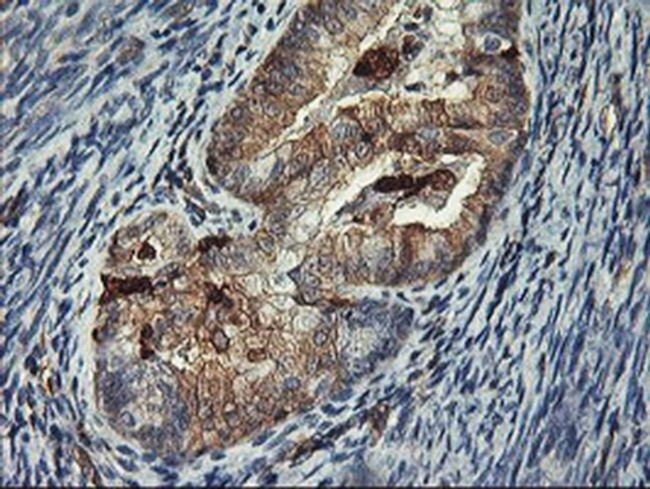 VASP Antibody in Immunohistochemistry (Paraffin) (IHC (P))