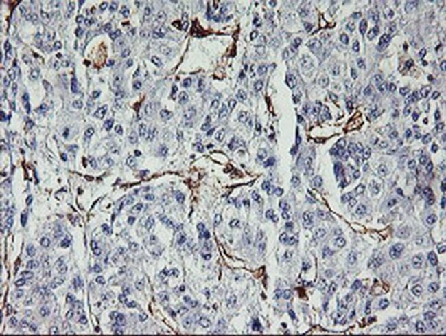 VASP Antibody in Immunohistochemistry (Paraffin) (IHC (P))