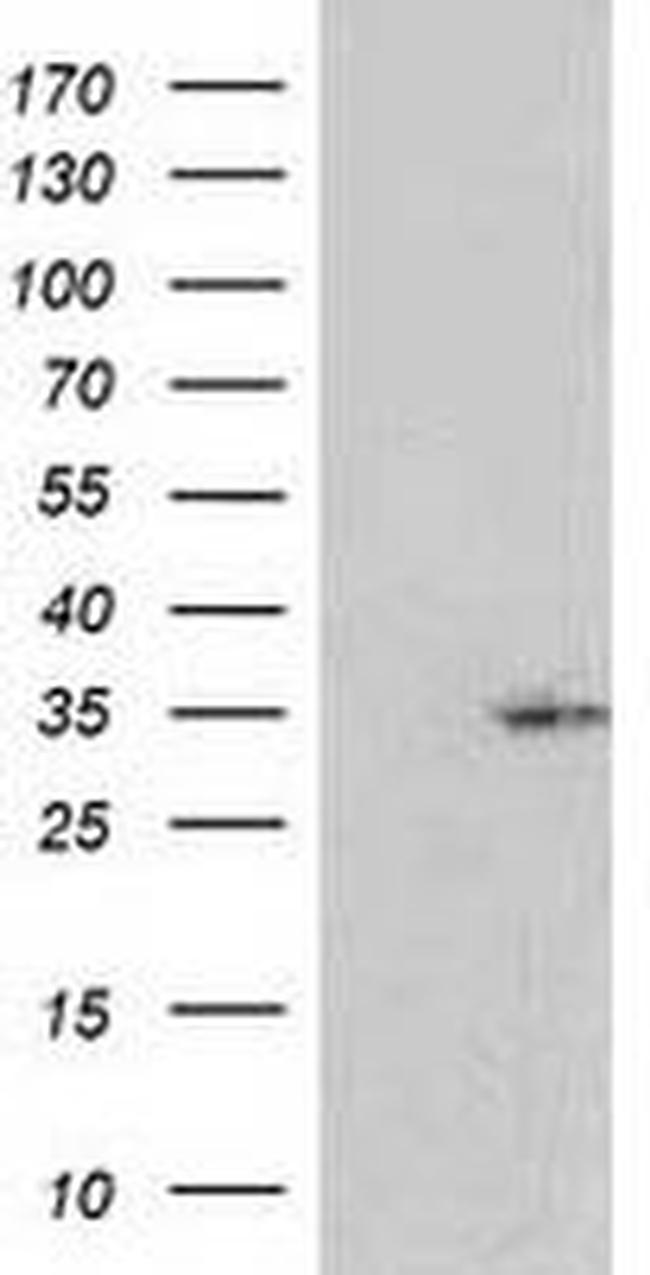 NORE1 Antibody in Western Blot (WB)