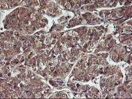 HDHD1 Antibody in Immunohistochemistry (Paraffin) (IHC (P))