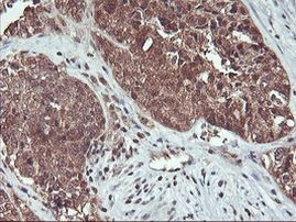 HDHD1 Antibody in Immunohistochemistry (Paraffin) (IHC (P))